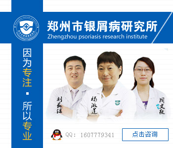郑州治疗牛皮癣最好的医院